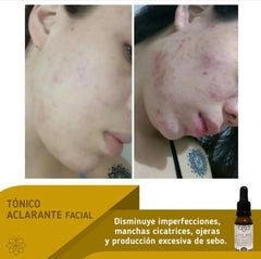 TÓNICO ACLARANTE CLASS GOLD PARA EL ROSTRO 25ML